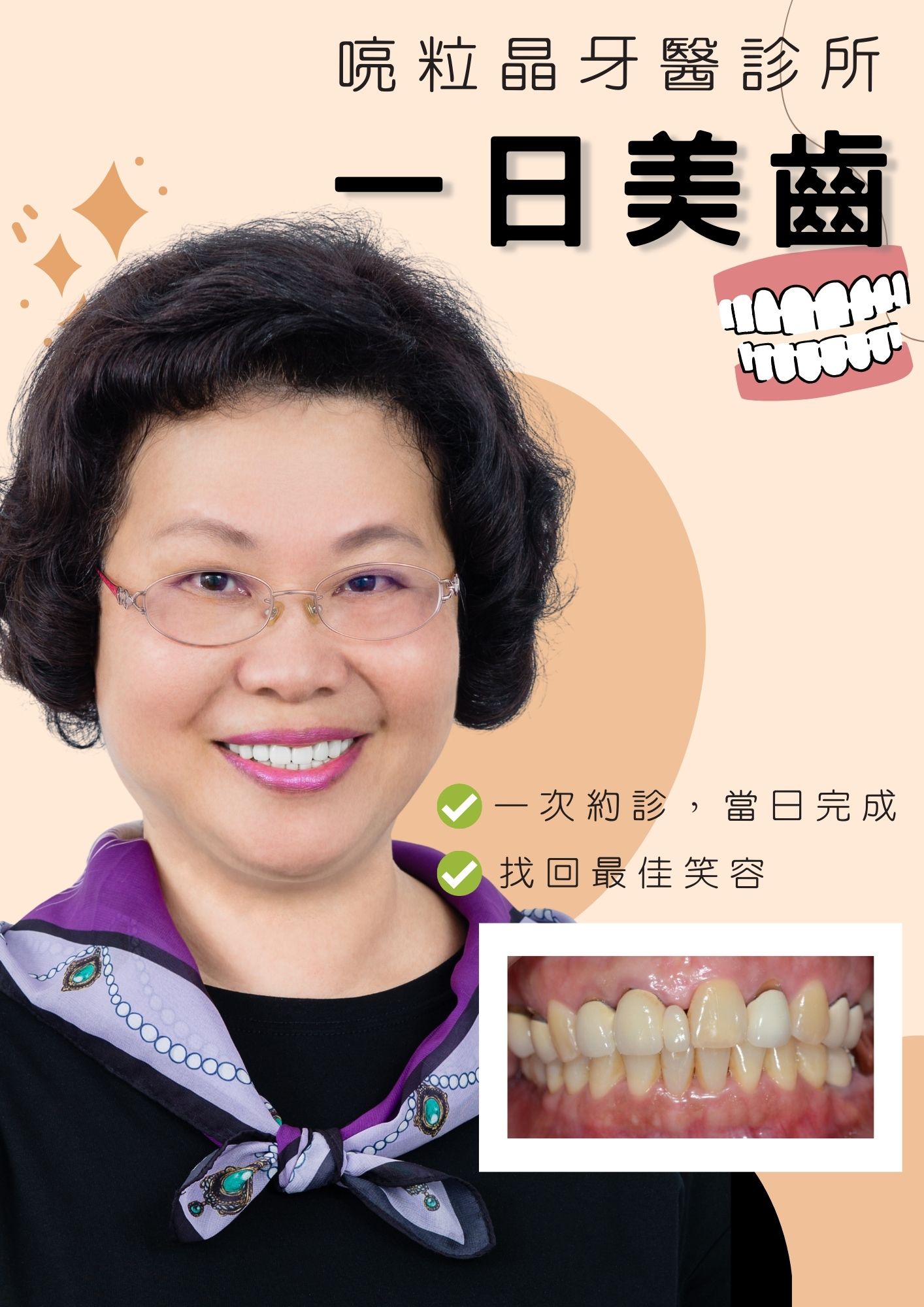 【牙齒美白案例-喨粒晶牙醫診所】一日美齒，一次約診，當日完成，找回最佳笑容